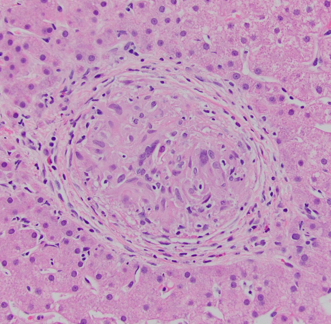 ACG 2021 Annual Meeting Posters